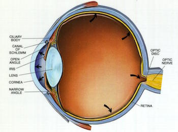 GLAUCOMA, DALLA DIAGNOSI AL TRATTAMENTO